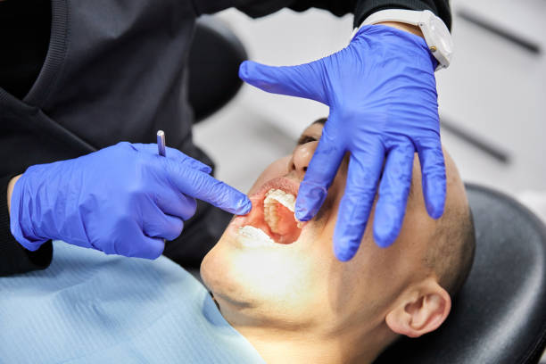 Best Emergency Wisdom Tooth Extraction in Murfreesboro, NC