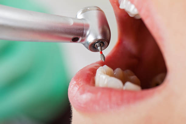 Best Emergency Care for Gum Disease in Murfreesboro, NC
